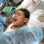 Prosedur Medis Sunat Dengan Menggunakan Teknologi Laser