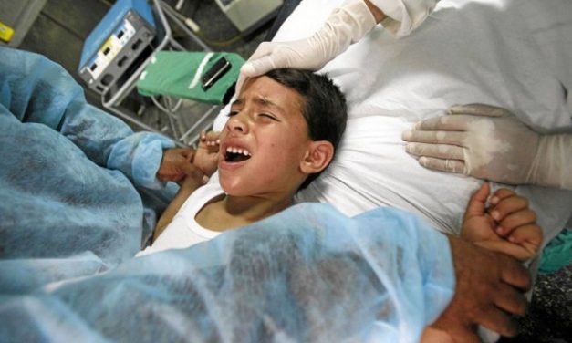 Prosedur Medis Sunat Dengan Menggunakan Teknologi Laser