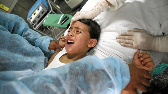 Prosedur Medis Sunat Dengan Menggunakan Teknologi Laser