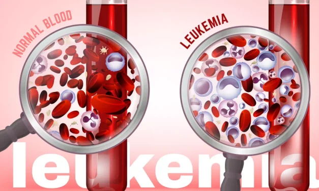 Penyakit Langka Kanker Darah Atau Leukemia