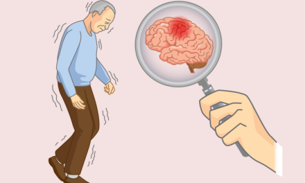 Penyerangan Otak Pada Sebuah Penyakit Alzheimer