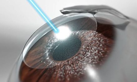 Pembedahan Mata Dari Beberapa Penyakit Dengan Lasik