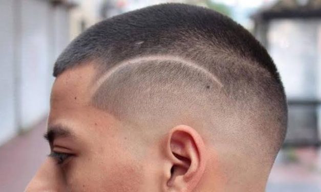 Gaya Pada Rambut Botak Yang Di Alami Seseorang