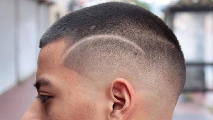 Gaya Pada Rambut Botak Yang Di Alami Seseorang